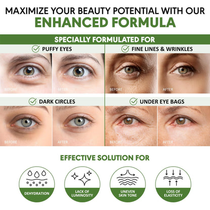 Green Tea Under-Eye Patches — 30 Pairs
