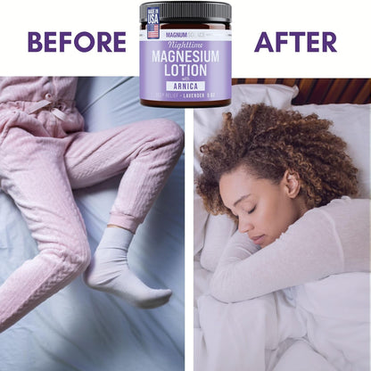 Nighttime Magnesium Lotion with Arnica – Highly Concentrated Magnesium for Muscles & Joints – Apply to Legs or Feet before Bed – Skin-Friendly